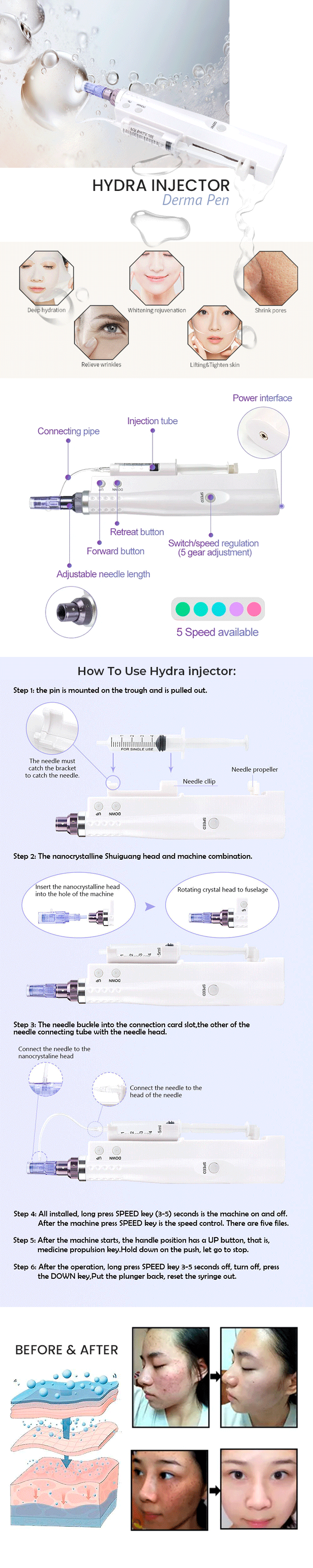 Hydra Injector 상페