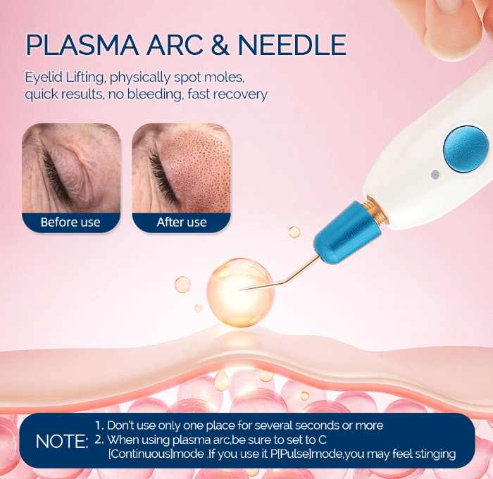 Plasma