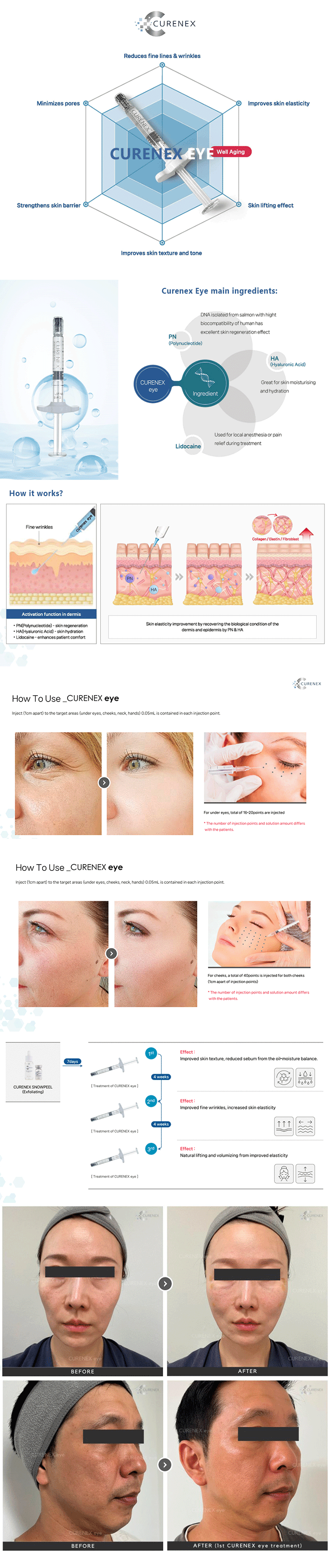 Curenex eye 상페